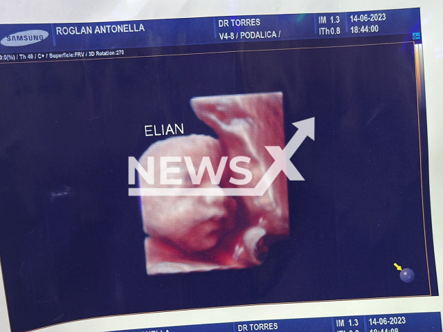 Photo shows a 5D ultrasound of a baby, undated. A clinic in Argentina allegedly scammed several mothers by giving them the same 5D ultrasound of a baby. Note: Picture is private (Newsflash)