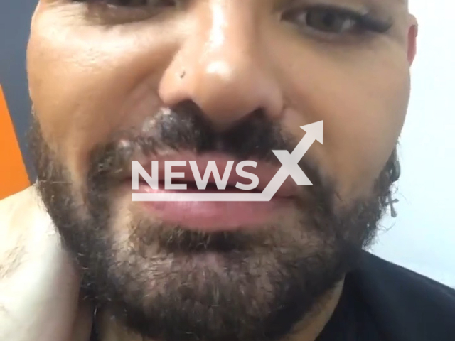 Photo shows how Francisco Mariano Ibanez looks like now, undated. He claims he was left disfigured after having more than 30 surgeries to look like Ricky Martin. Note: Picture is a screenshot from a video (@franmarianocoach/Newsflash)