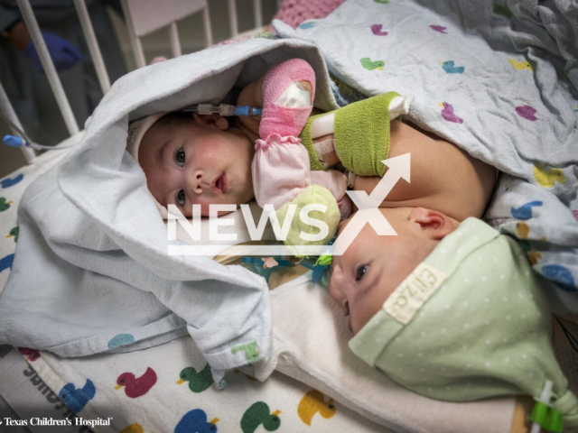 Photo shows the formerly conjoined twins Ella Grace and Eliza Faith Fuller. They were successfully separated at Texas Children's Hospital and are ready to go home.
Note: Licensed photo(Texas Children’s Hospital/Newsflash).