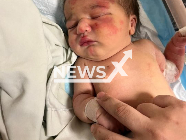 Photo shows the baby girl that was found in a black plastic bag being carried by a stray dog in Tripoli, Lebanon, undated. She was saved by a passerby who heard the sounds of a baby’s cries coming from the bag. Note: Private photo. (Newsflash)