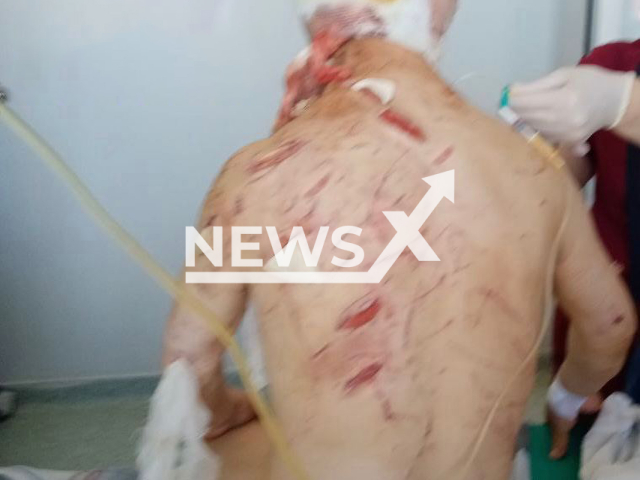 Picture shows injured Oleg Laptander, 55, in hospital in Salekhard, Yamalo-Nenets Autonomous Okrug, Russia on Thursday, July 20, 2023. He saved the family from white bear and hardly survived after a fight with the beast in Yamal Peninsula, northwest Siberia, Russia. Note: Private photo. (Newsflash)