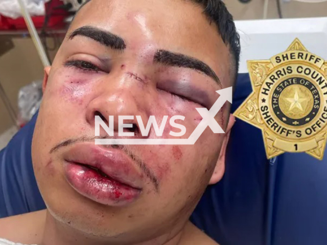 Picture shows injured J. Valdiviez, undated. The Harris County Jail detention officer was attacked by inmate. Note: Private photo. (GoFundMe/Newsflash)