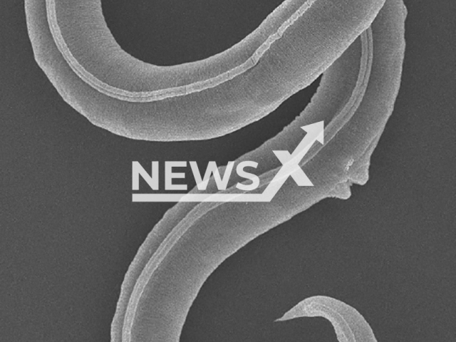 Image shows the Panagrolaimus kolymaensis nematode, undated photo. It was discovered by researchers from the Institute of Physicochemical and Biological Problems in Soil Science RAS in Russia in the Siberian Permafrost. Note: Licensed content. (Alexei V. Tchesunov and Anastasia Shatilovich, Institute of Physicochemical and Biological Problems in Soil Science RAS/Newsflash)