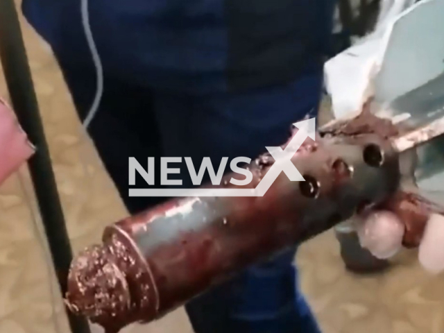 Picture shows unexploded shell removed from the body of wounded soldier at frontline hospital during war in Ukraine, undated. Also Russian military doctors removed an unexploded RPG-26 shell from the ankle of a wounded soldier. Note: Photo is a screenshot of video. (Newsflash)