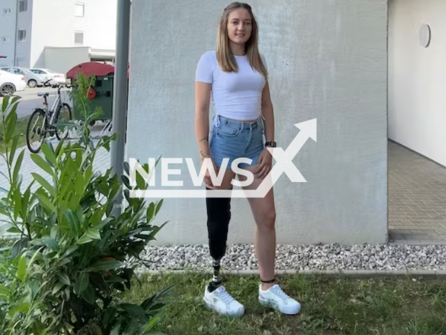 Image shows Katja Pschait, 27, from the municipality of Gralla, Styria State, Austria, undated photo. Her leg was amputated on Dec. 7, 2020. Note: Private photo. (Newsflash)