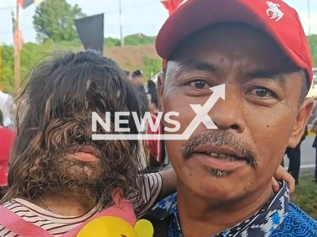 Picture shows Missclyen Roland and her father, undated. The child from Bintulu, Sarawak in Malaysia has a rare congenital syndrome. Note: Image is a screenshot from video. (Newsflash)