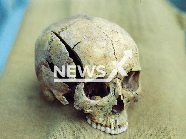 Photo shows a cranial trauma that bears witness of a violent death. International team of researchers analyzed over 3,500 skulls found in the Middle East, In the 12,000 years before antiquity.
Note: Licensed photo(Joachim Wahl,University of Tubingen/Newsflash).