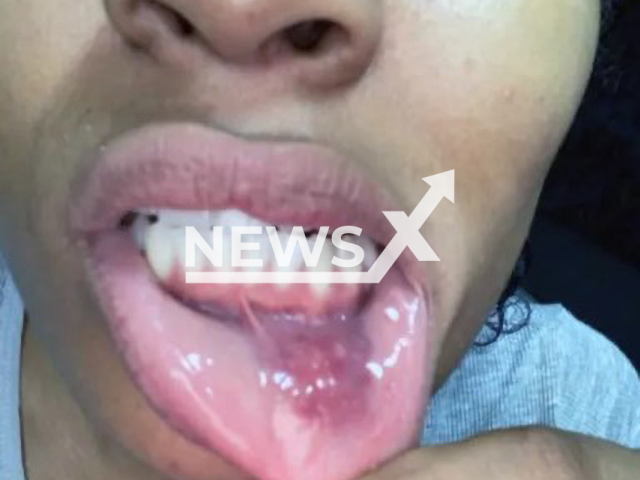 Photo shows the injuries on Patricia Ramos, undated. The Brazilian presenter and influencer filed a complaint against her ex-husband Diogo Vitorio in October, 2023, claiming he attacked her. Note: Private photo(Patricia Ramos/Newsflash).