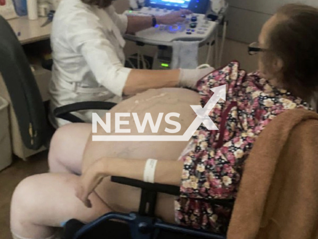 Photo shows a patient who had a huge ovarian cyst, undated. The cost was removed in Bolshoy Kamen, Primorsky Krai, Russia. Note: Picture is private (@kkb2prim/Newsflash)