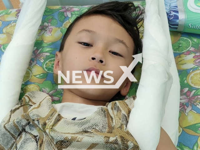 Photo shows a child who broke his spike while playing at a park in Volgograd, Russia, undated. He became bedridden following the incident. Note: Picture is private (Zhenya Raushanova/Newsflash)