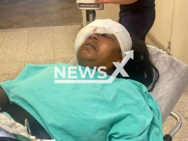 Picture shows injured Daiane Cristina, undated. She was hit in the face by a stray bullet in Sao Paulo, Brazil. Note: Private photo. (Newsflash)