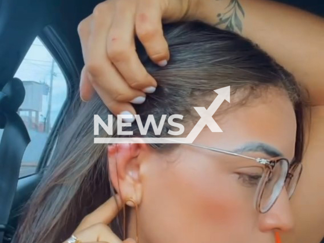 Raylland Ferreira Barros shows her ear, undated. Part of her ear bitten off after collecting a customer's debt in Araguaina, Brazil. Note: Image is a screenshot from video. (@rayllandf/Newsflash)