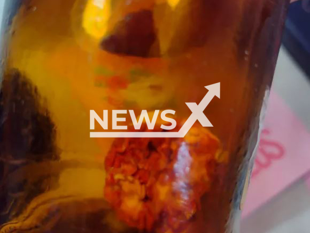 The unidentified object at the bottom of a beer bottle that looked like a piece of meat, in Praia Grande, Brazil, in April, 2022.  
Note: Private photo.  (Marcos Francisco de Jesus/Newsflash)