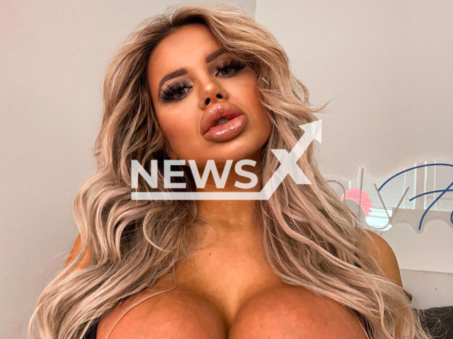 Jessy Bunny, 21, has spent more than EUR 50,000 on beauty surgeries, and lost contact with her family because of this, in Vienna, Austria.
Note: Private photo.  (@jessy.bunny.official/Newsflash)