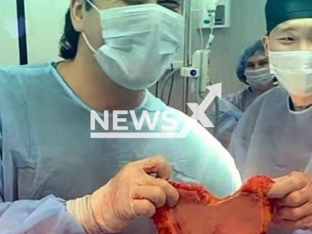 Plastic surgeon Rustam Kurmanbaev holds heart shaped patient's skin in operation room in Novosibirsk, Russia, undated. This was how he allegedly congratulated his colleague on her birthday. Note: Private photo taken from local media. (Rustam Kurmanbaev/Newsflash)