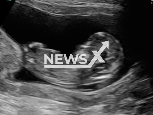 Image shows the ultrasound image of the infant, undated photo. Brazilian YouTuber and writer Viih Tube, 23, and Eliezer do Carmo Neto, 34, are expecting their second child. Note: Private photo from social media. (@pequenoravi/Newsflash)