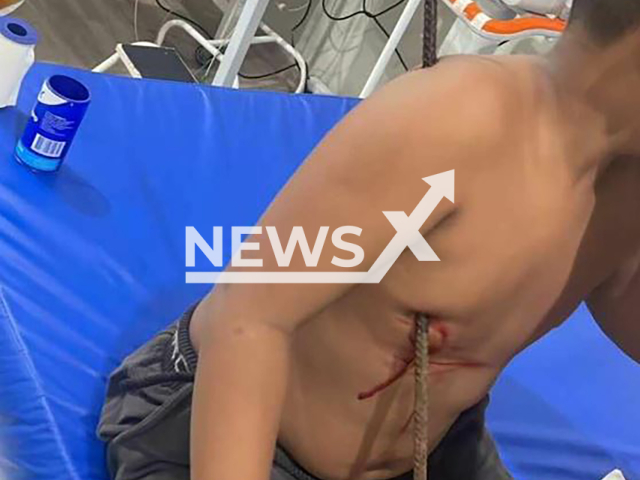 Picture shows a boy that was impaled by a rod in Abaetetuba, Brazil, on Monday, June 17, 2024. It hapen after he fell in a construction area. Note: Private photo taken from local media. (Newsflash)