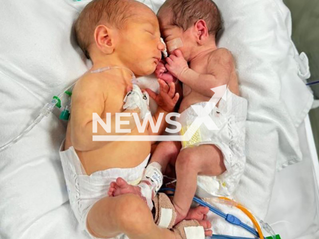 Picture shows  twin babies born with a difference of one kilogramme and five centimetres in length, undated. They were born on Wednesday, June 12, in Florianopolis, Brazil, and  twins remain hospitalized.
Note: Private photo taken from local media. (Hospital da Ilha/Newsflash)