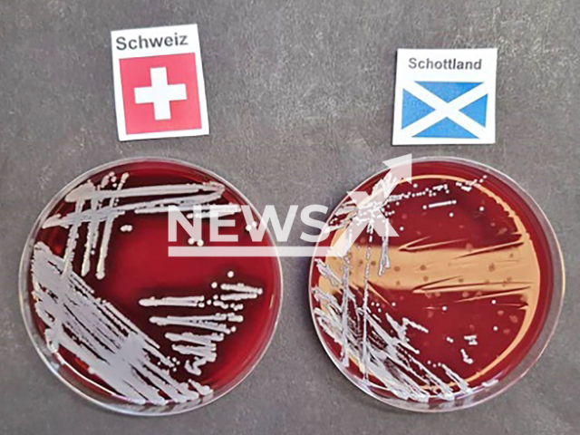 Image shows the bacteria, undated photo. The Cantonal Hospital Baden, Switzerland, used it to predict EURO 2024 winners. Note: Photo is a screenshot from a social media post. (Newsflash)