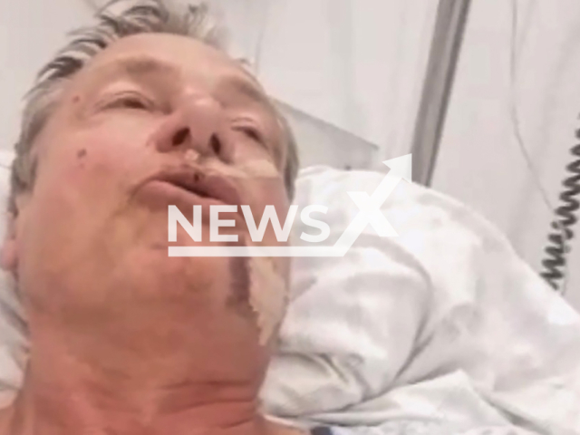 Image shows Michael Stuerzenberger, 59, in the hospital, undated photo. He was injured by Sulaiman Ataee, 25, in Mannheim, Germany. Note: Photo is a screenshot from a video. (Newsflash)