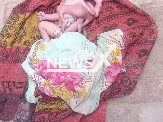 Picture shows the baby with two faces, four arms and four legs in Uttar Pradesh's Sitapur, India, undated. The baby passed away. Note: Private photo taken from social media. (Newsflash)