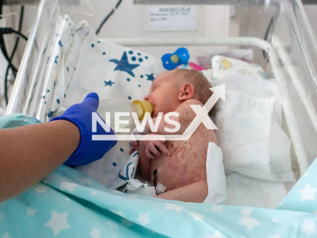 Photo shows newborn Maria at the Regional Perinatal Center of Kursk, Russia on Monday, July 29, 2024. The baby was found in a field lying in an anthill. Note: Photo is obtained from the Regional Perinatal Center of Kursk. (@opckursk_vk/Newsflash)