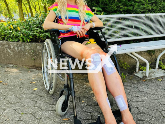 Theresia Fischer, 32, from Hamburg, Germany, poses in undated photo. She underwent another leg surgery. Note: Private photo from social media. (@theresiafischer/Newsflash)