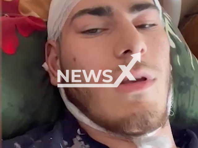 Photo shows injured student Elmin Allahverdiyev, 21, from Republic of Bashkortostan, Russia after visiting the horror quest room.  Actor scared visitors of horror quest so much that they fell from the second floor on the street and were hospitalized. Note: Photo is a screenshot from a video. (Newsflash)