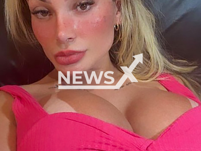 Andressa Urach, 37, shows off her face after tattooing freckles in undated photo. She has several tattoos on her body. Note: Private photo taken from social media. (@andressaurachoficial/NF/newsX)