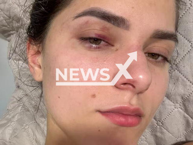 Image shows Guilheny Abramoski, 22, from Rio Branco, Acre State, Brazil, undated photo. She accused her husband businessman Nasser Chami of domestic violence. Note: Private photo from local media. (NF/newsX)