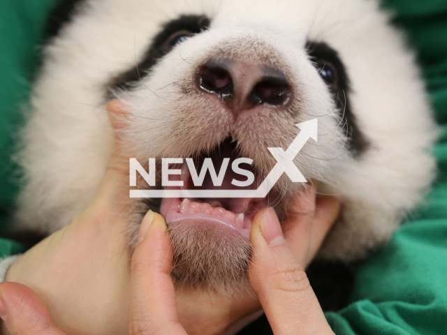 Image shows one of the two panda cubs' set of teeth, undated photo. The two female pandas were born in Berlin Zoo, Germany, on Aug. 22, 2024. Note: We have obtained permission to use this photo from Svenja Eisenbarth. (Berlin Zoo/NF/newsX)