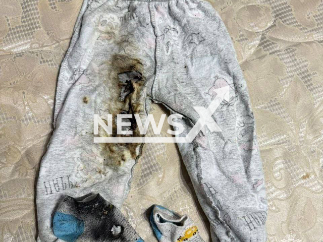 Photo shows burned clothes of the 9 month old baby in Votkinsk, Udmurt Republic, Russia on Monday, Dec. 9, 2024. The baby was injured after phone caught fire near. Note: Licensed emergency photo. (@mchsUR, NF/newsX)