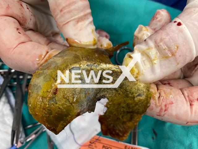 Vets discovered a tennis ball stuck in the stomach of a dog in Idaho, States. Note: We have obtained permission for this picture (West Valley Humane Society/Newsflash)