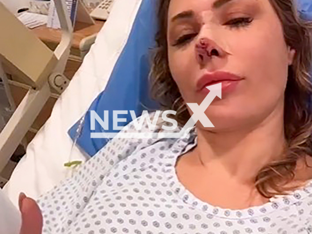 Picture shows Brazilian influencer Ju Isen, undated. She was attacked by a dog in Mexico. Note: Image is a screenshot from video. (@juisen/NF/newsX)