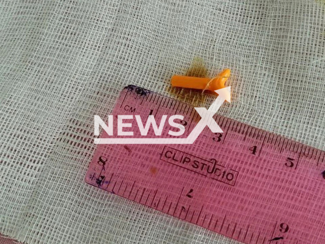 Picture shows the Lego piece removed from the ear of a patient at the Prokopyevsk City Hospital in Russia, undated. She lived with it for 20 years. Note: Licensed photo. (Minister of Health of Kuzbass/NF/newsX)