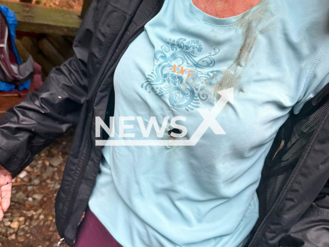 Picture shows the burned shirt of one of the tourists, undated. Two German tourists were rescued after they were struck by lightning in the Ore Mountains, the Czech Republic, on May, 3rd, 2025, Note: Photo from Mountain Rescue Service of the Czech Republic. (@horskasluzba.cz/Newsflash/NX)
