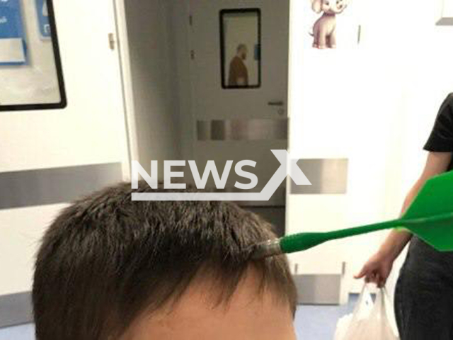Photo shows dart stuck in 10-year-old boy's skull, undated. He underwent urgent surgery and is now recovering, officials in Moscow, Russia, stated on 6 May 2025. Note: Licensed photo. (Ministry of Health of Moscow Region/Newsflash/NX)