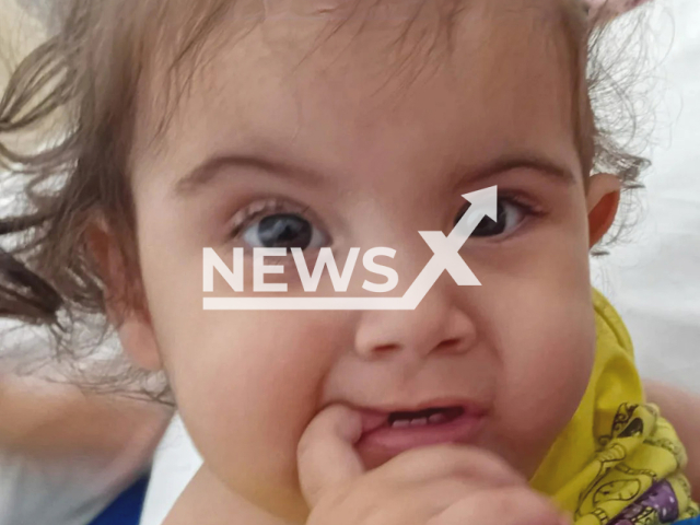 Picture shows Kiraz, undated. Siamese twins Kiraz and Aruna underwent surgery in Goiania, Brazil on May 10, 2025. Note: Private photo taken from social media. (@kirazaruna/Newsflash/NX)