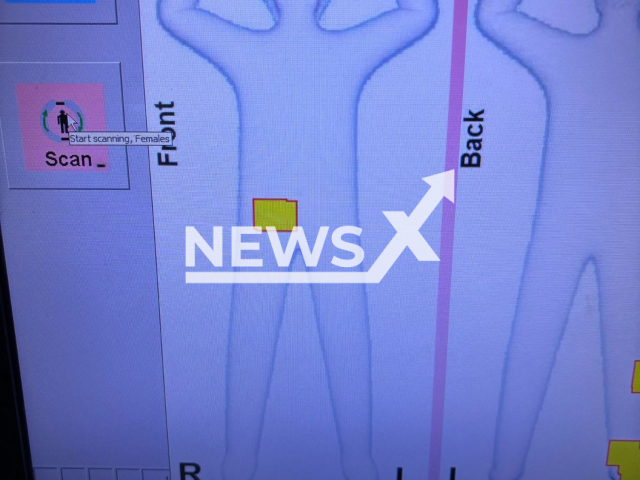 Picture shows an X-ray of the suspects, undated. Three women were caught smuggling gold in their privates at the Istanbul Airport, Turkey, on Apr.25, 2025. Note: Private photo taken from local media. (Newsflash/NX)