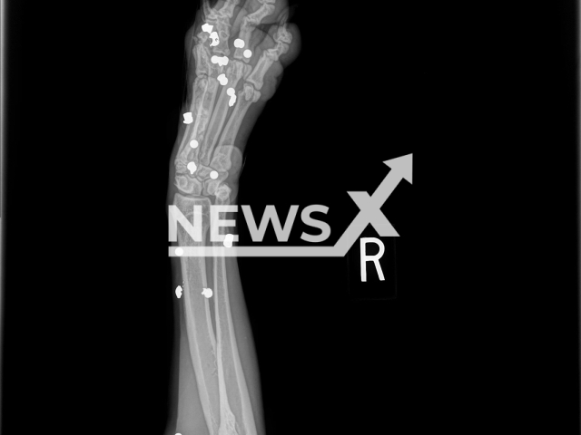 An X-ray of the injuries of one of the dogs Riva, in April, 2022, in Spring Hill, Florida, USA.
Note: Police photo. (Hernando County Sheriff's Office/Newsflash)