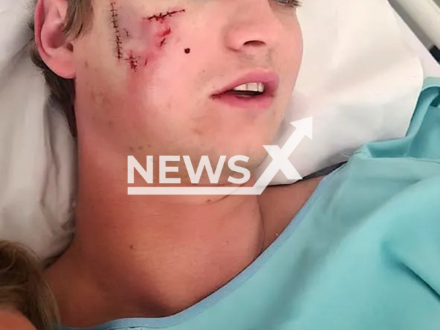 Picture shows Nicolas Hohls, 27, in hospital, undated. He was attacked by hyenas at Cape Vidal in northern KwaZulu-Natal in South Africa. Note: Private photo. (Newsflash/NX)