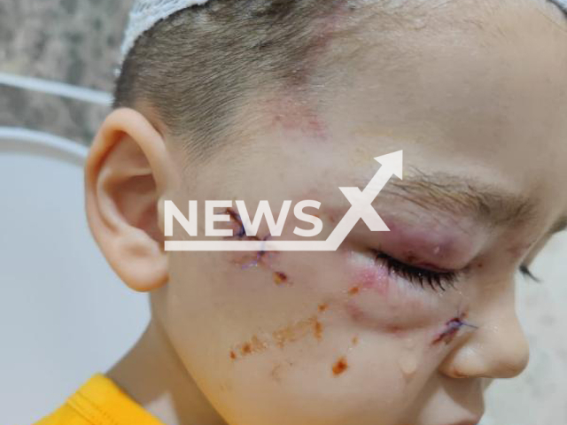 Atabey Eryurekli (pictured) was allegedly attacked by one of the dogs participating in the dog beauty contest held in Adana, Turkey on 7th May 2022. Note: Private picture (Newsflash)