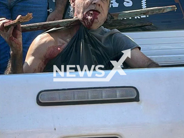 Picture shows the man with the wood impaled, undated. A 61-year-old man fell while pruning a mango tree in Xambre, Brazil. Note: Private photo. (Newsflash/NX)
