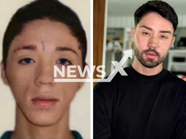 Rico Melquiades, 34, before and after procedures, undated. He was stopped at immigration at Dubai airport. Note: Private photo. (@ricoof/Newsflash/NX)