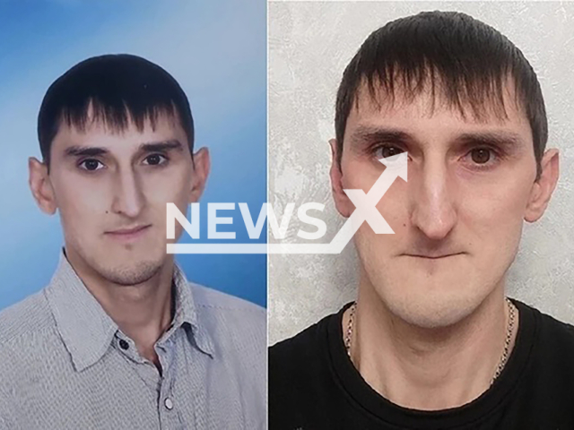 Picture shows Andrey Mullin before (left) and after (right) teeth extraction, undated. He was forced to pull out his healthy teeth in Naberezhnye Chelny, Russia. Note: Private photo. (Newsflash)