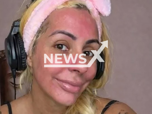 Picture shows Debora Dunhill, 39, undated. She suffered allergic reaction after applying menstrual blood to her face. Note: Private photo. (Newsflash)
