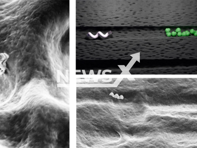 Left: Nanobots entering a dentinal tubule. Centre top and bottom: Schematic representation and electron microscope image of nanobot moving through dentinal tubule to reach bacterial colony. Right: How locally induced heat from nanobot can kill bacteria. Live bacteria are green and dead bacteria are red. Bottom right shows band where targeted treatment has been done in human teeth. Note: Press release photo (Theranautilus/Newsflash)