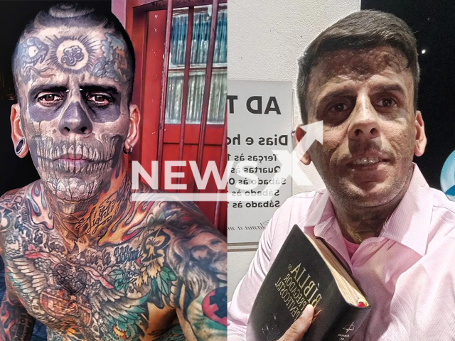 Picture shows Leandro de Souza before the procedure (left) and after (right), undated. He  had 95% of his body covered in tattoos. Note: Private photo taken from social media. (@leandrodesouzabless/Newsflash/NX)