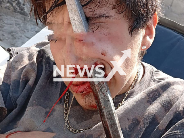 Picture shows injured Brayan de Jesus Barrera, 18, undated. A metal bar pierced his face in Tlahuac, Mexico. Note: Photo from SIADE. (Grupo SIADE/Newsflash)