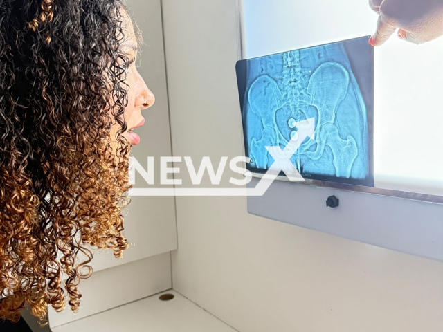 Picture shows Brazilian influencer Emelly Souza, 24, undated. The balls used in the exercise became lodged inside her vagina. Note: Photo obtained with permission. (@souaemelly, CO Assessoria/Newsflash)
